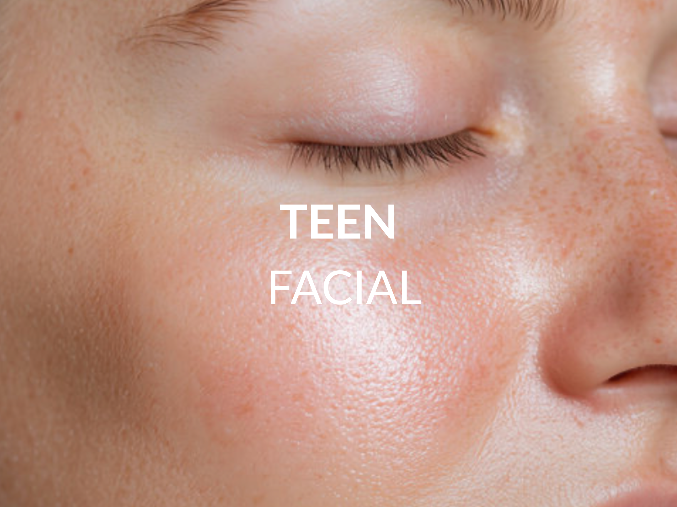 Teen Facial treatment at Beauty Ranch Medical Spa