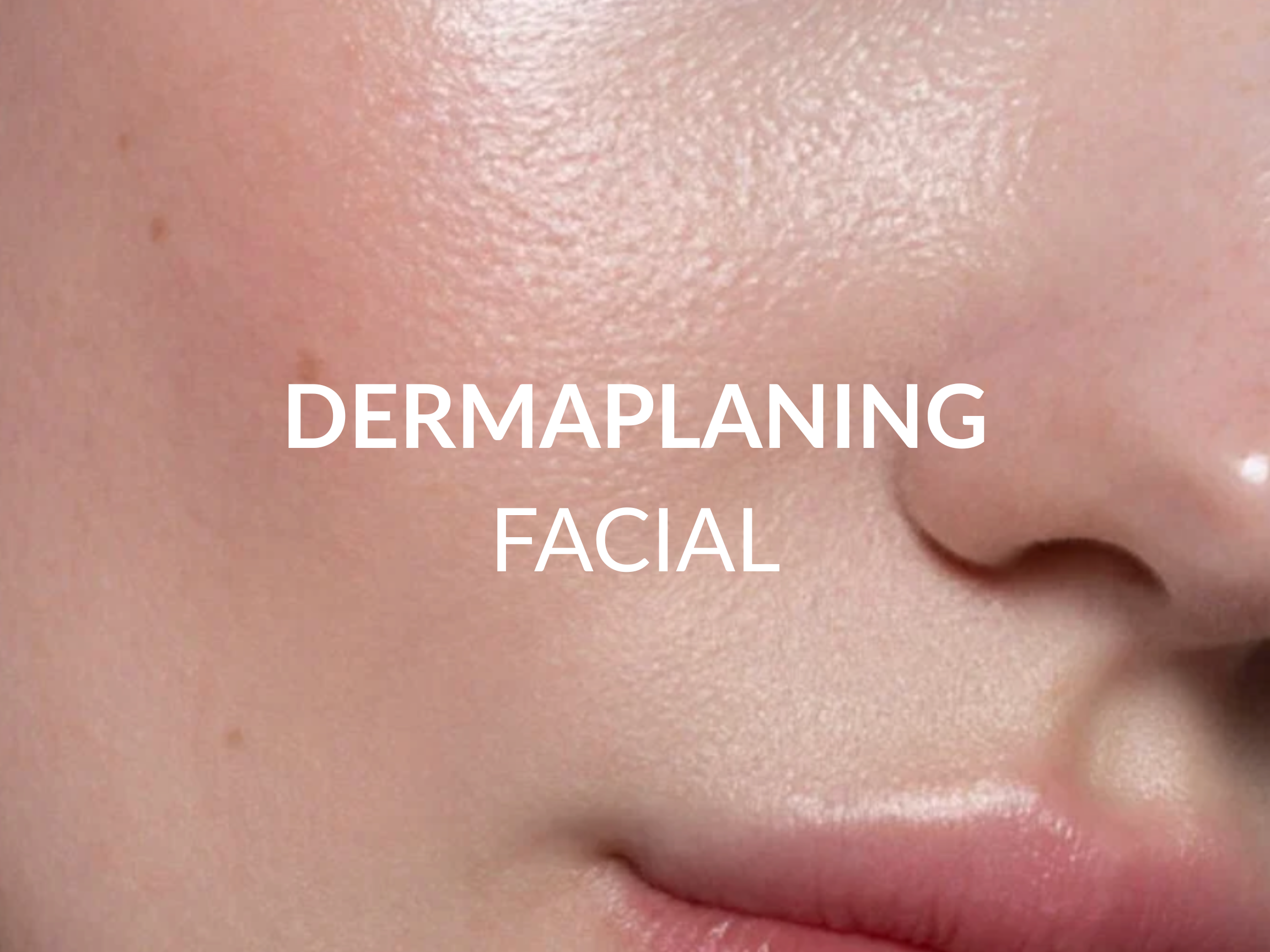 Dermaplaning treatment at Beauty Ranch Medical Spa