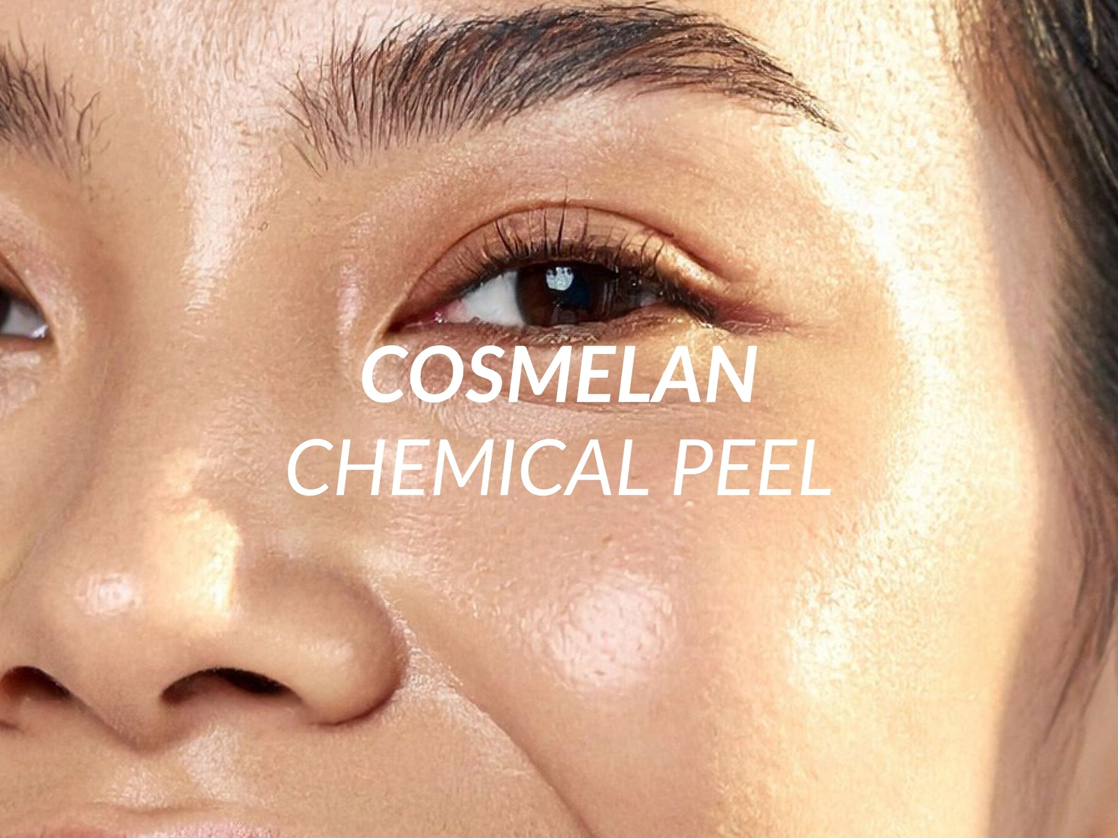 Cosmelan treatment at Beauty Ranch Medical Spa