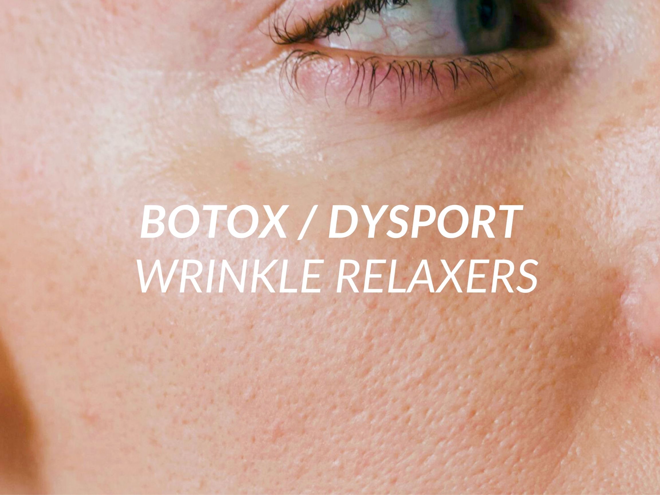 Botox / Dysport treatment at Beauty Ranch Medical Spa