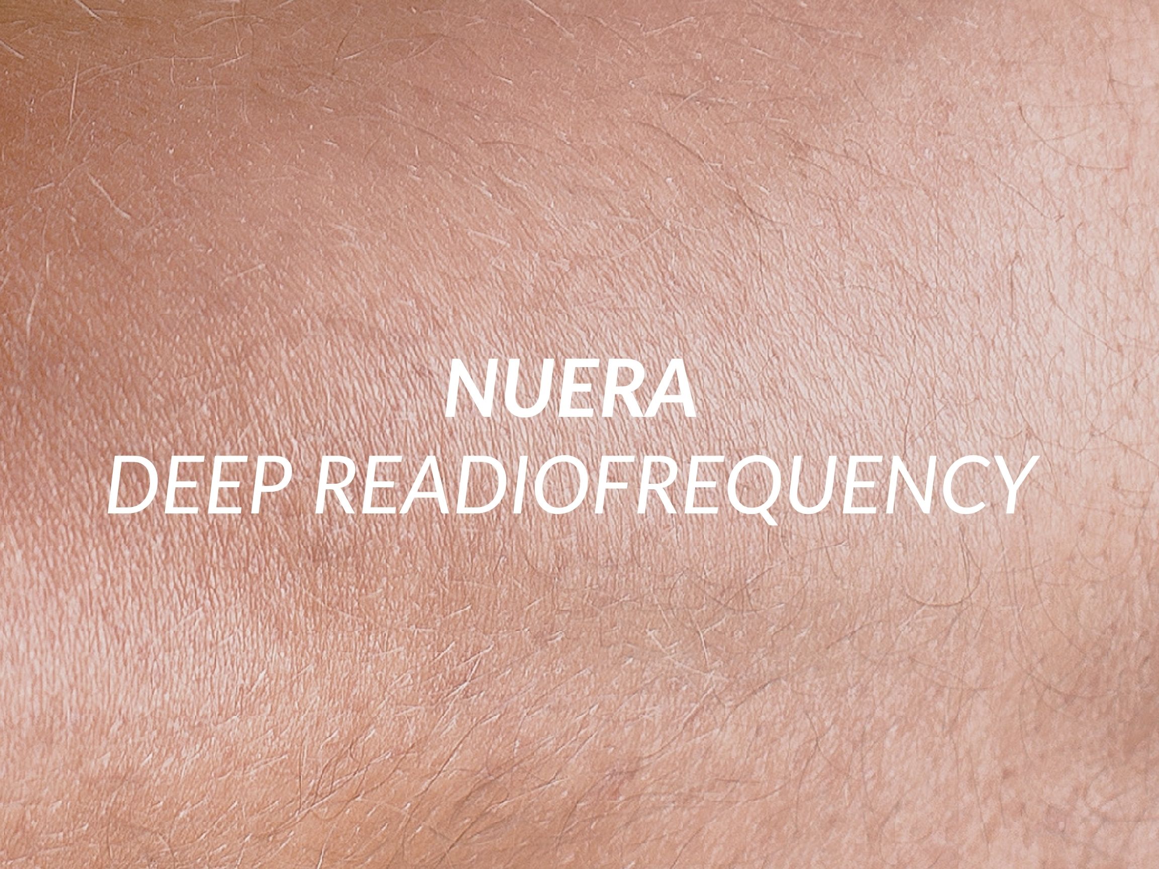 NuEra treatment at Beauty Ranch Medical Spa