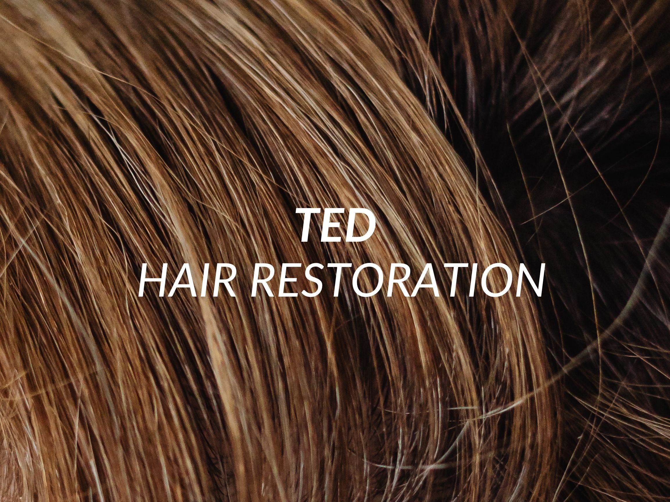 TED treatment at Beauty Ranch Medical Spa