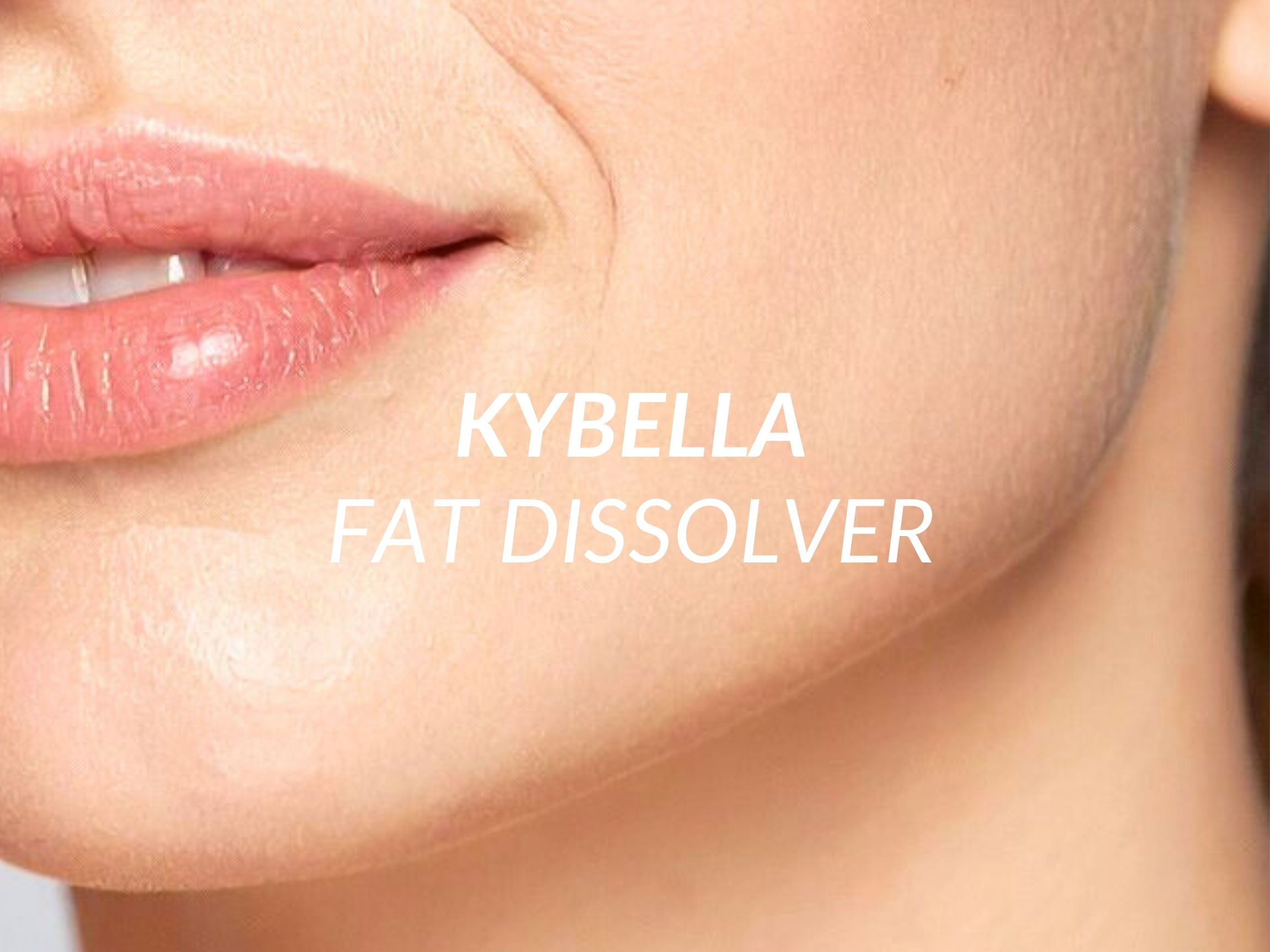 Kybella treatment at Beauty Ranch Medical Spa