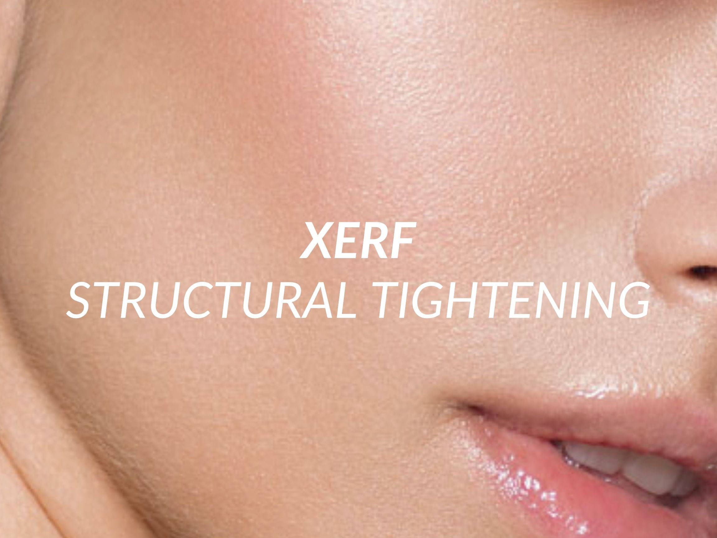 Xerf treatment at Beauty Ranch Medical Spa