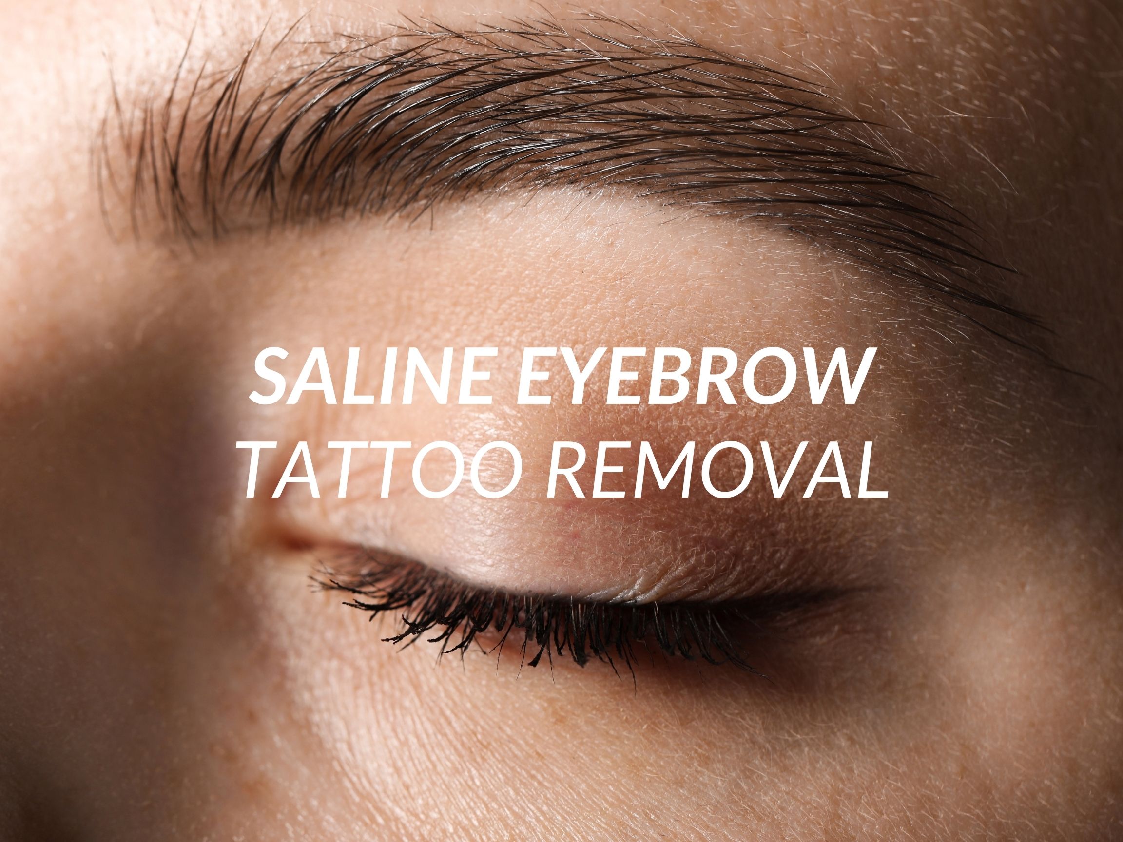 Saline Eyebrow Tattoo Removal treatment at Beauty Ranch Medical Spa