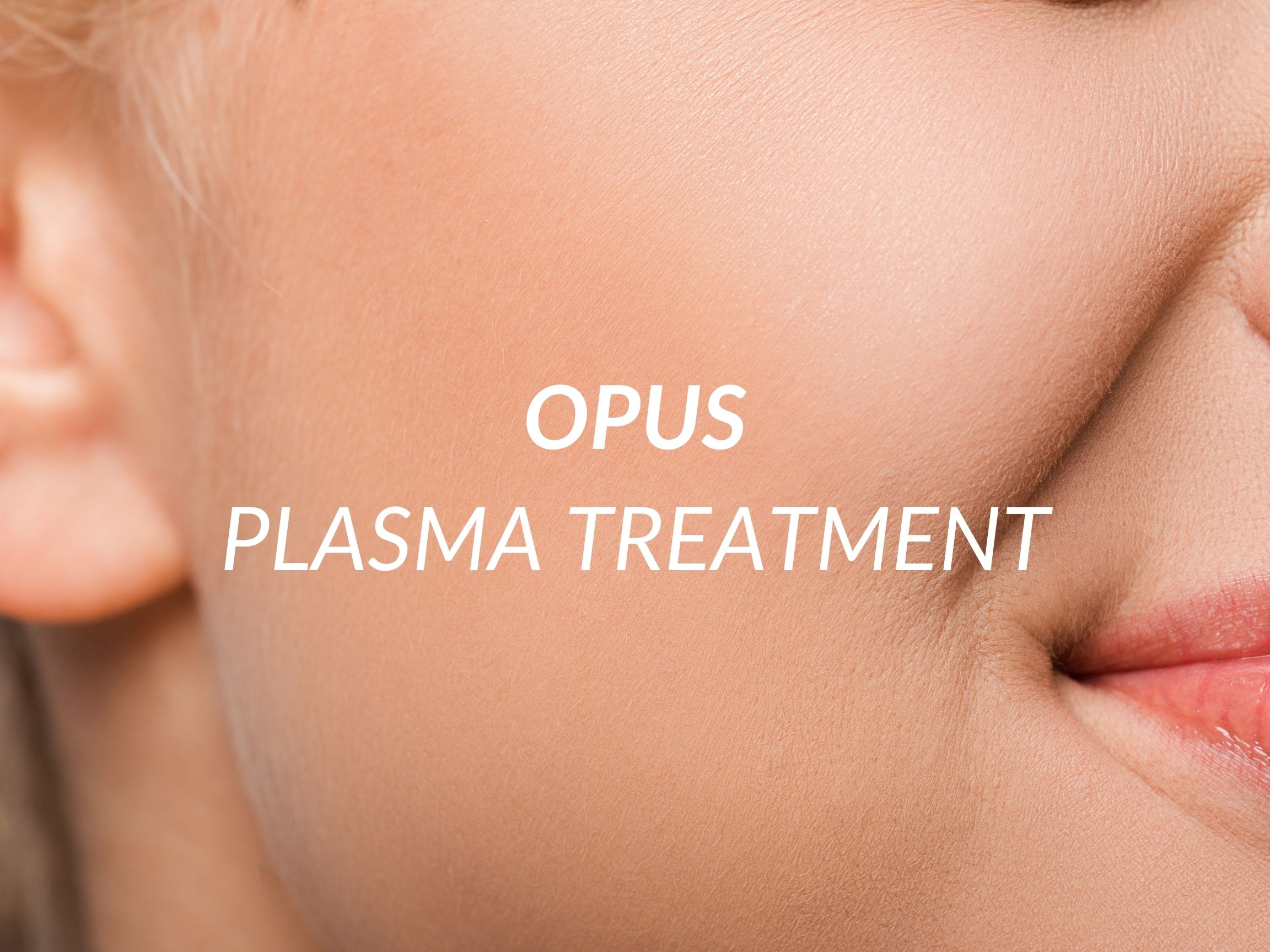 Opus Plasma treatment at Beauty Ranch Medical Spa