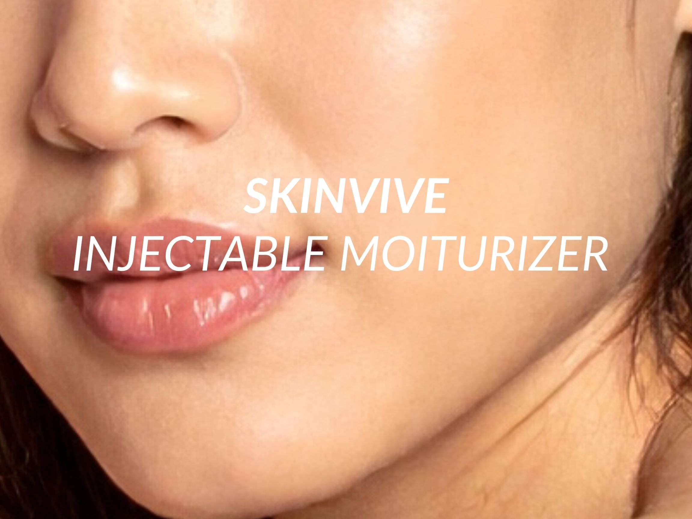 SkinVive treatment at Beauty Ranch Medical Spa