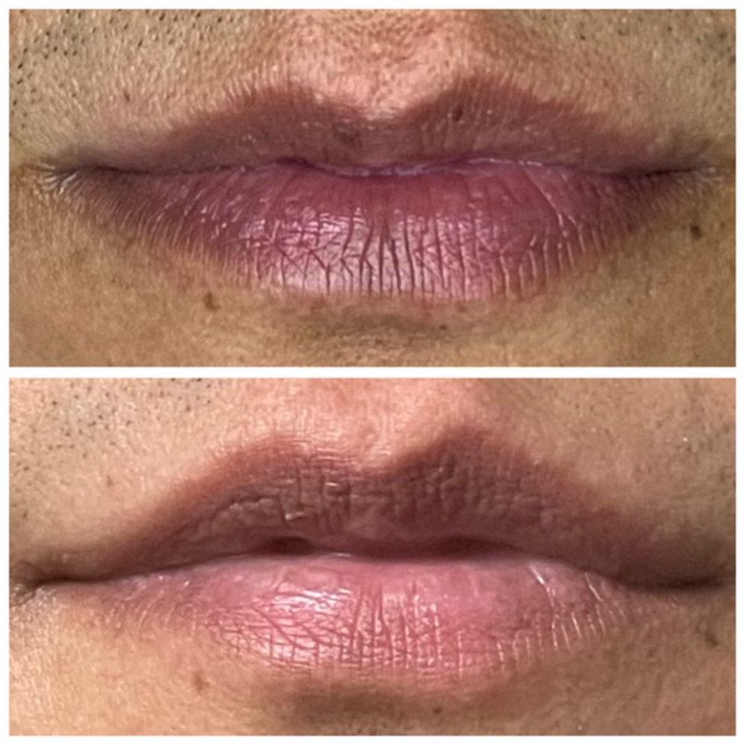Lip blushing neutralization and color correction result — Beauty Ranch Medical Spa