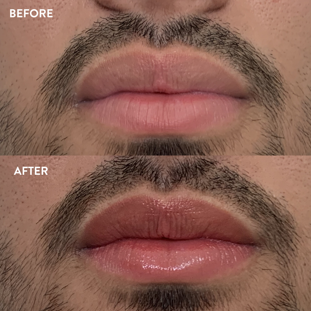 Lip blushing neutralization and color correction before and after — Beauty Ranch Medical Spa